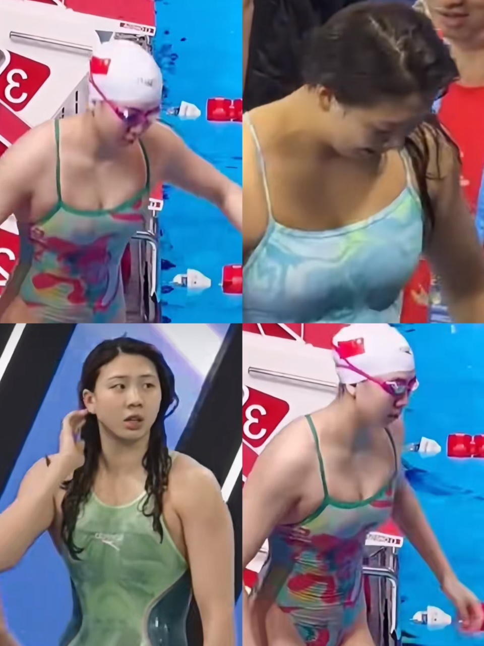 胶原蛋白和, 锻炼方式, 副乳 胶原蛋白和, 锻炼方式, 副乳